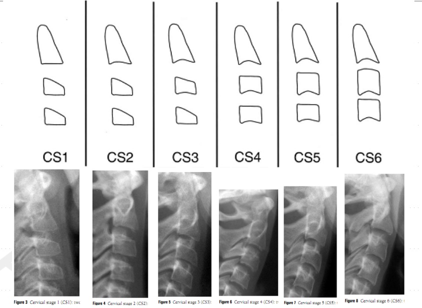 Phân tích tăng trưởng CVM chia sự tăng trưởng làm 6 giai đoạn: được gọi từ CS1 -> CS6