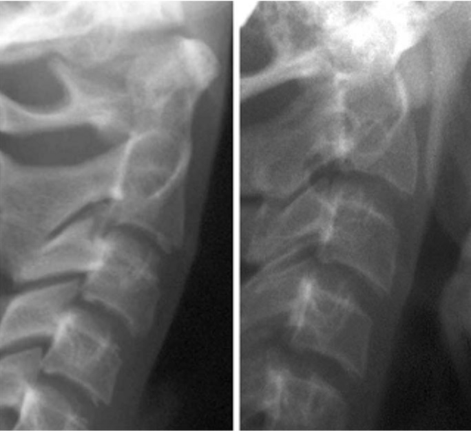 Đỉnh tăng trưởng xảy ra trong vòng 1-2 năm trước thời kỳ này