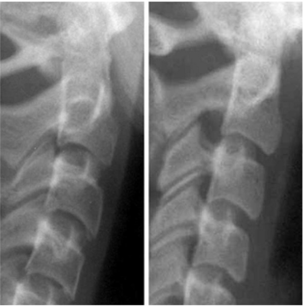 Đỉnh tăng trưởng đã kết thúc 1 năm trước thời kỳ này