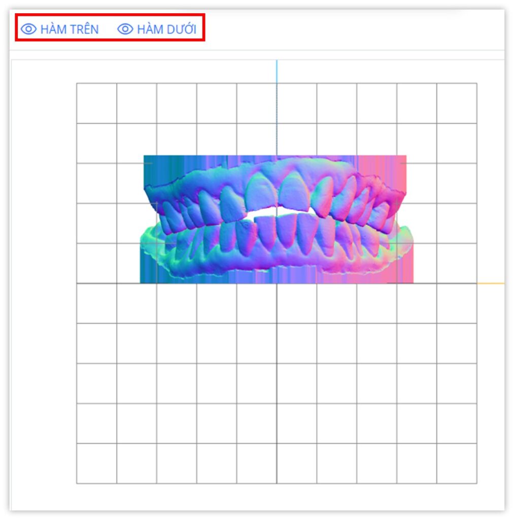 Lưu trữ ảnh mẫu hàm 3D - Kết quả
