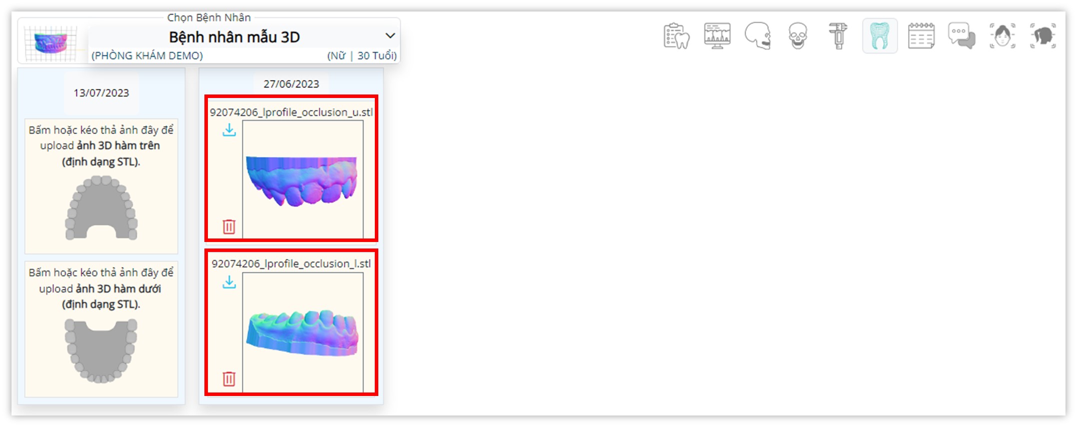 Lưu trữ ảnh mẫu hàm 3D - Xem file