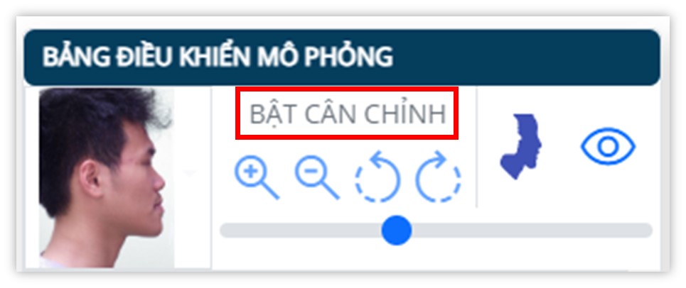 Phân tích phim sọ mặt nghiêng - Bật cân chỉnh