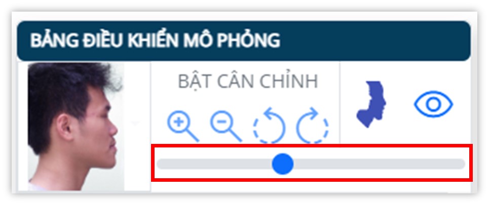 Phân tích phim sọ mặt nghiêng - Chế độ hiện phim sọ nghiêng