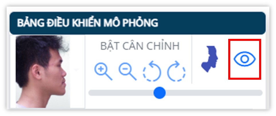 Phân tích phim sọ mặt nghiêng - Giả lập gần nhất