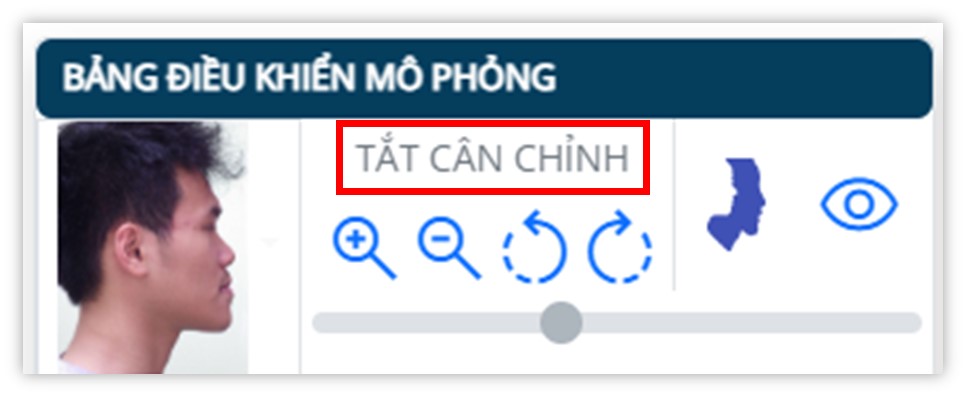 Phân tích phim sọ mặt nghiêng - Tắt cân chỉnh