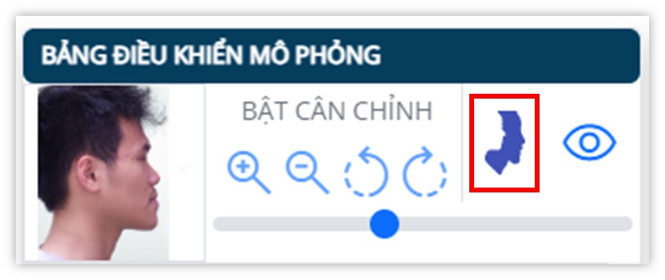 Phân tích phim sọ mặt nghiêng - Thực hiện giả lập