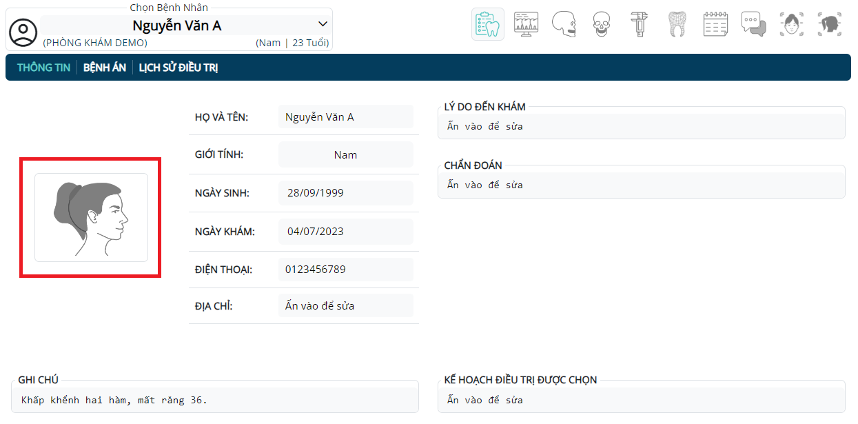Tạo bệnh án mới - Ảnh mặt nghiêng của bệnh nhân